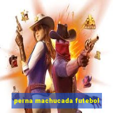 perna machucada futebol