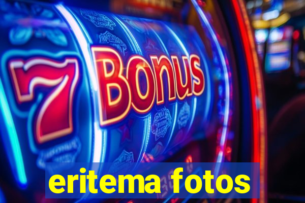 eritema fotos